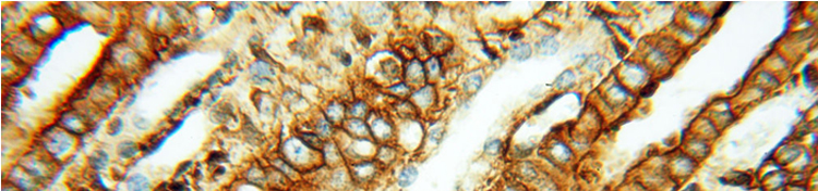 功能蛋白的表达水平内参抗体