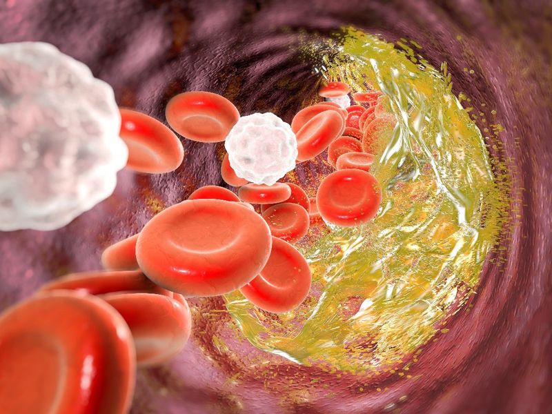 Read more about the article 帮助抗炎药物靶向治疗动脉粥样硬化的纳米微球长啥样？