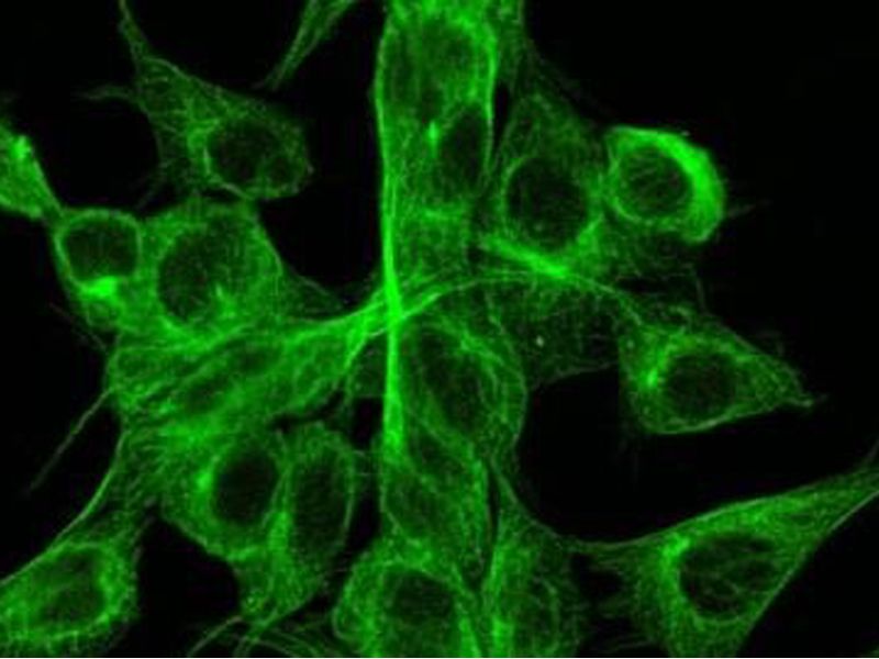 Read more about the article 流式细胞术知识分享 — 试剂篇