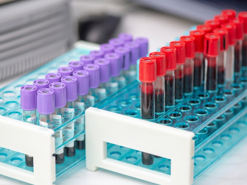 Read more about the article ELISA通关必备丨样本篇丨常见样本丨血清血浆