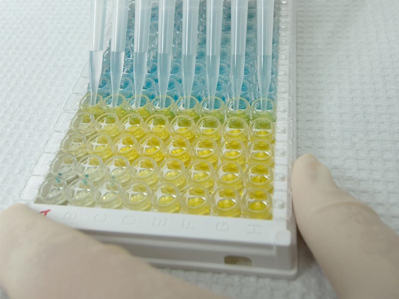 Read more about the article ELISA通关必备丨数据篇丨标准曲线不佳