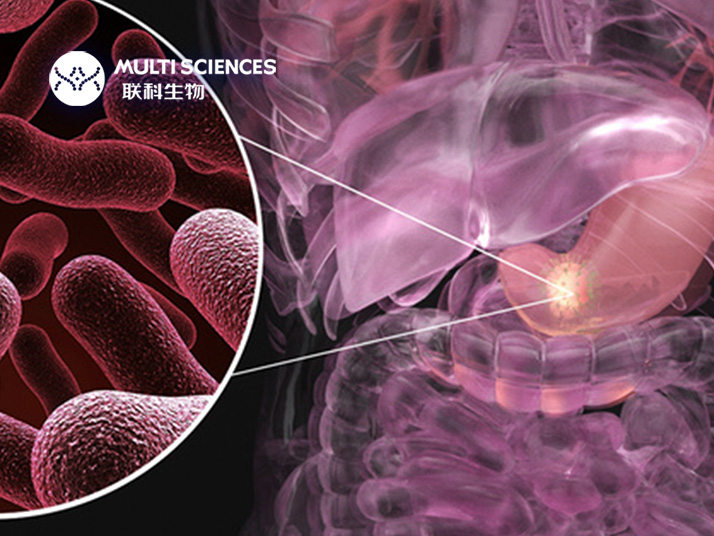 Read more about the article 论文分享 | 新发现 一种促进胃癌发展的基因