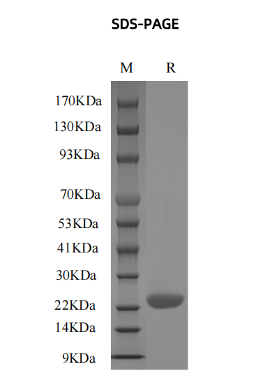 SDS-PAGE测定,纯度大于95% - 结果示例图片
