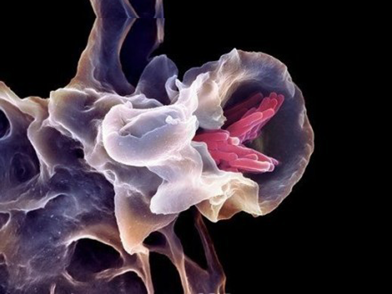 Read more about the article MerTK-巨噬细胞的界定标准