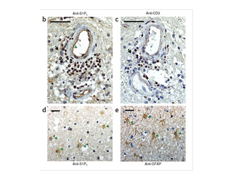 Read more about the article 2013年联科生物免疫学最新进展Ⅱ