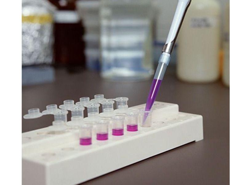 Read more about the article 联科推荐：人FGF-21 ELISA检测试剂盒