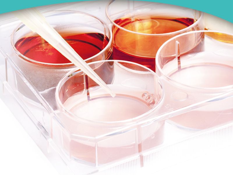 培养器皿 : 各种孔板细胞接种量小结