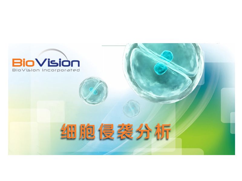 Read more about the article 区域迁移的“细胞侵袭”是几个意思？