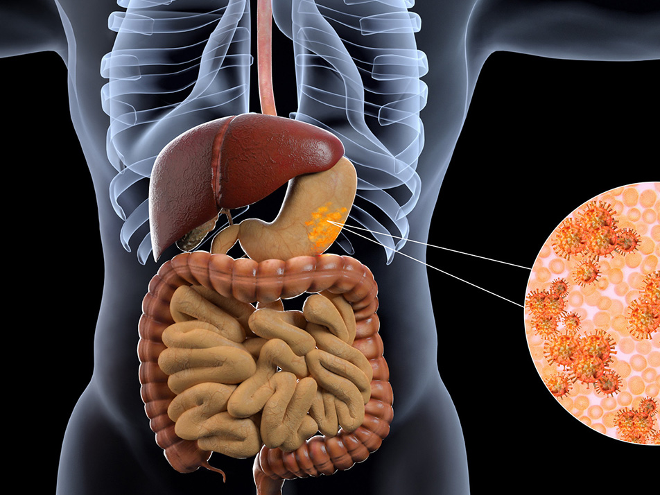 Read more about the article 论文分享 | 联科流式抗体助力胃癌的微环境研究