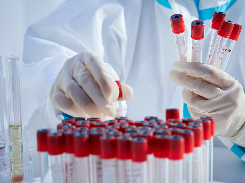 Read more about the article 流式三要素之一 | 样本篇